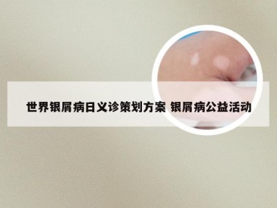 世界银屑病日义诊策划方案 银屑病公益活动