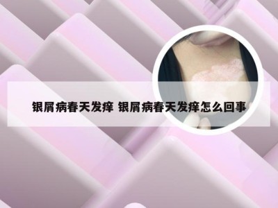 银屑病春天发痒 银屑病春天发痒怎么回事