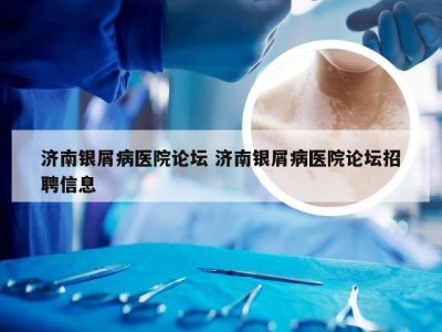 济南银屑病医院论坛 济南银屑病医院论坛招聘信息