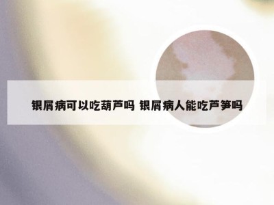 银屑病可以吃葫芦吗 银屑病人能吃芦笋吗