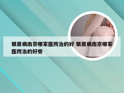 银屑病南京哪家医院治的好 银屑病南京哪家医院治的好些