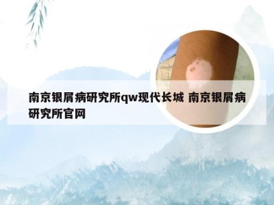 南京银屑病研究所qw现代长城 南京银屑病研究所官网