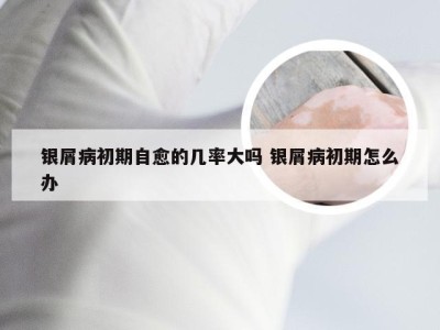 银屑病初期自愈的几率大吗 银屑病初期怎么办