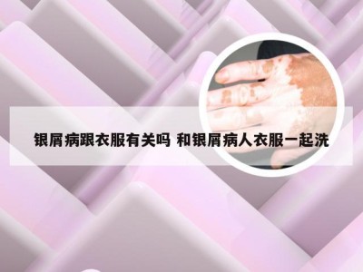 银屑病跟衣服有关吗 和银屑病人衣服一起洗