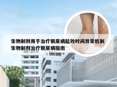 生物制剂用于治疗银屑病起效时间异常机制 生物制剂治疗银屑病指南