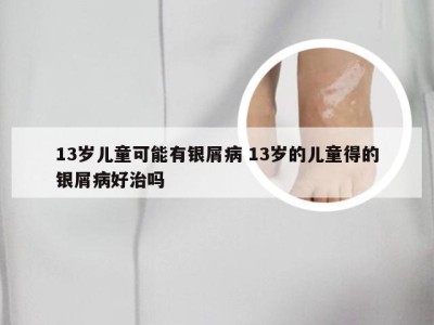 13岁儿童可能有银屑病 13岁的儿童得的银屑病好治吗