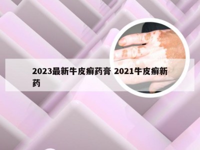 2023最新牛皮癣药膏 2021牛皮癣新药