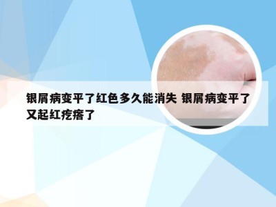 银屑病变平了红色多久能消失 银屑病变平了又起红疙瘩了