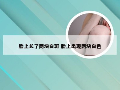 脸上长了两块白斑 脸上出现两块白色