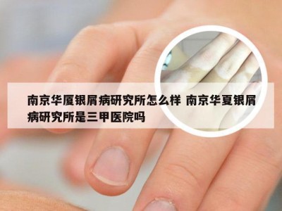 南京华厦银屑病研究所怎么样 南京华夏银屑病研究所是三甲医院吗