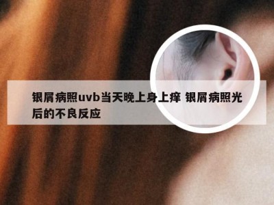 银屑病照uvb当天晚上身上痒 银屑病照光后的不良反应