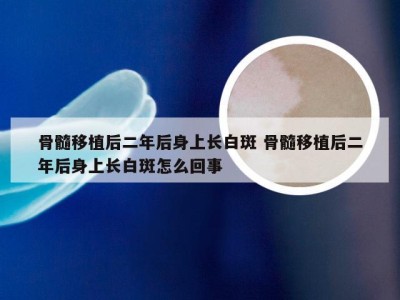 骨髓移植后二年后身上长白斑 骨髓移植后二年后身上长白斑怎么回事