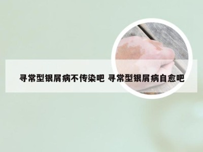 寻常型银屑病不传染吧 寻常型银屑病自愈吧