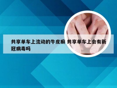 共享单车上流动的牛皮癣 共享单车上会有新冠病毒吗