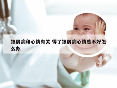 银屑病和心情有关 得了银屑病心情总不好怎么办