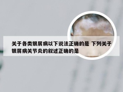 关于各类银屑病以下说法正确的是 下列关于银屑病关节炎的叙述正确的是