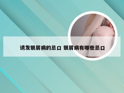 诱发银屑病的忌口 银屑病有哪些忌口