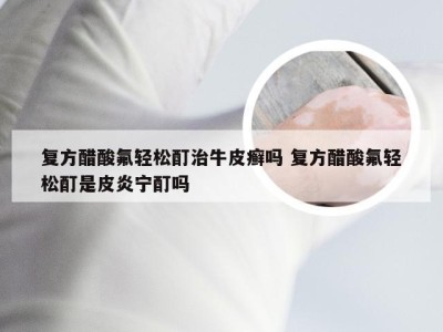 复方醋酸氟轻松酊治牛皮癣吗 复方醋酸氟轻松酊是皮炎宁酊吗