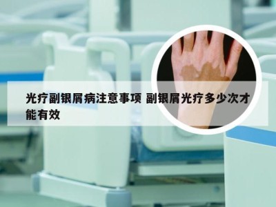 光疗副银屑病注意事项 副银屑光疗多少次才能有效