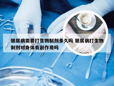 银屑病需要打生物制剂多久吗 银屑病打生物制剂对身体有副作用吗