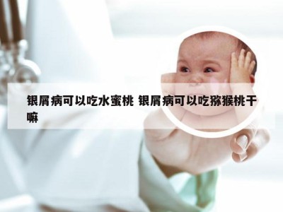 银屑病可以吃水蜜桃 银屑病可以吃猕猴桃干嘛