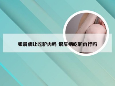 银屑病让吃驴肉吗 银屑病吃驴肉行吗