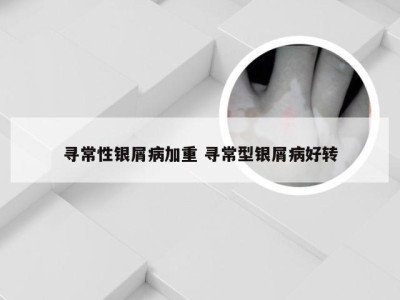 寻常性银屑病加重 寻常型银屑病好转