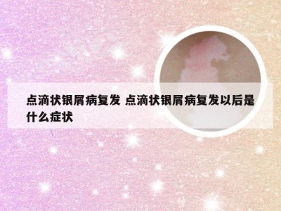 点滴状银屑病复发 点滴状银屑病复发以后是什么症状