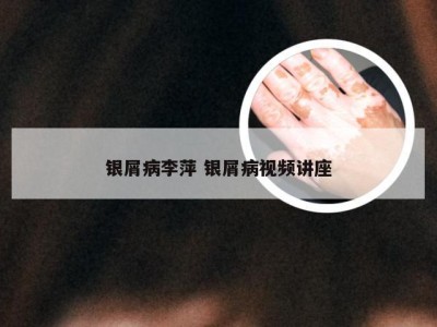 银屑病李萍 银屑病视频讲座