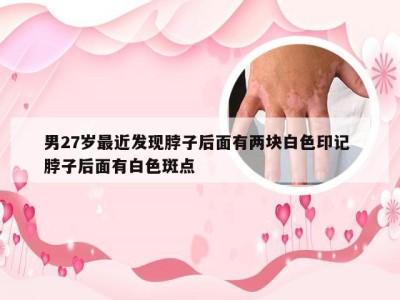 男27岁最近发现脖子后面有两块白色印记 脖子后面有白色斑点