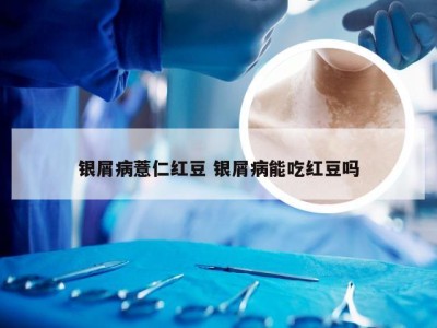 银屑病薏仁红豆 银屑病能吃红豆吗