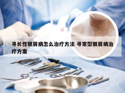 寻长性银屑病怎么治疗方法 寻常型银屑病治疗方案