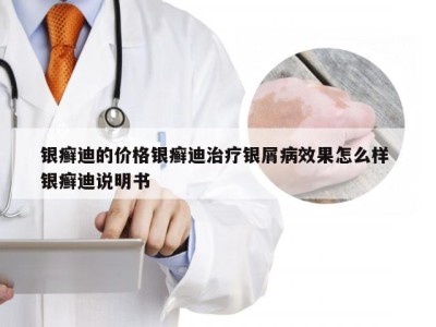 银癣迪的价格银癣迪治疗银屑病效果怎么样 银癣迪说明书
