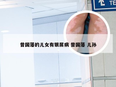 曾国藩的儿女有银屑病 曾国藩 儿孙