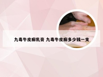 九毒牛皮癣乳膏 九毒牛皮癣多少钱一支