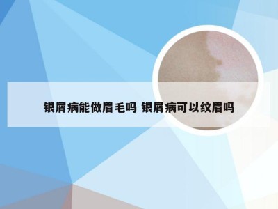 银屑病能做眉毛吗 银屑病可以纹眉吗