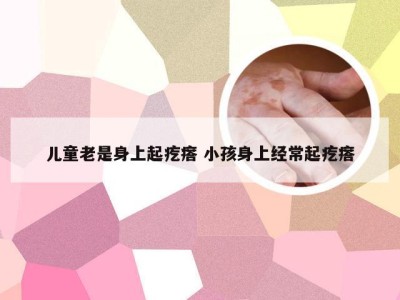 儿童老是身上起疙瘩 小孩身上经常起疙瘩