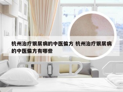 杭州治疗银屑病的中医偏方 杭州治疗银屑病的中医偏方有哪些