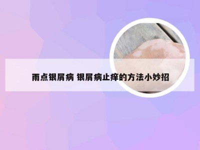 雨点银屑病 银屑病止痒的方法小妙招