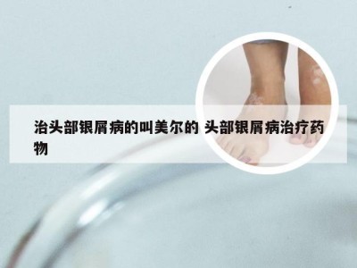 治头部银屑病的叫美尔的 头部银屑病治疗药物