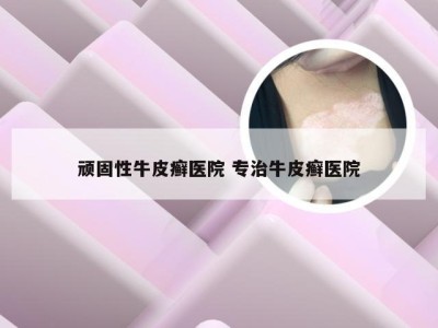 顽固性牛皮癣医院 专治牛皮癣医院
