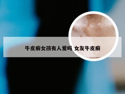 牛皮癣女孩有人爱吗 女友牛皮癣