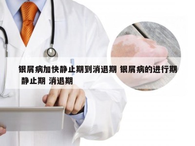 银屑病加快静止期到消退期 银屑病的进行期 静止期 消退期