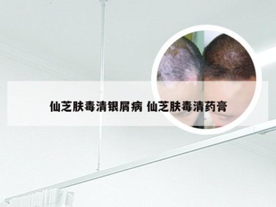 仙芝肤毒清银屑病 仙芝肤毒清药膏