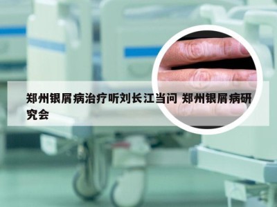 郑州银屑病治疗听刘长江当问 郑州银屑病研究会