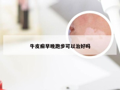 牛皮癣早晚跑步可以治好吗