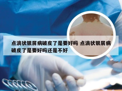 点滴状银屑病破皮了是要好吗 点滴状银屑病破皮了是要好吗还是不好