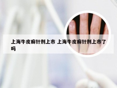 上海牛皮癣针剂上市 上海牛皮癣针剂上市了吗