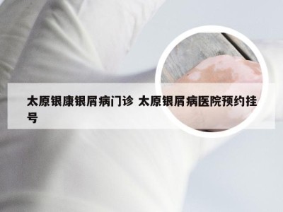 太原银康银屑病门诊 太原银屑病医院预约挂号