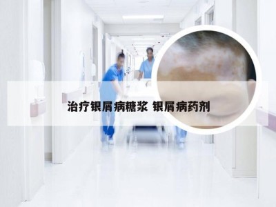 治疗银屑病糖浆 银屑病药剂